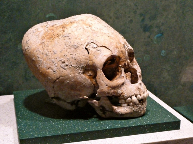 Alien Skulls Alien Skulls?